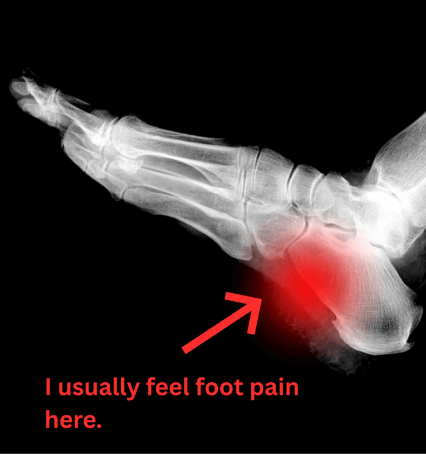 Where I feel foot pain
